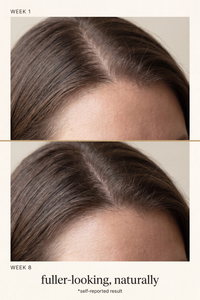 Korean Scalp Revival Bar